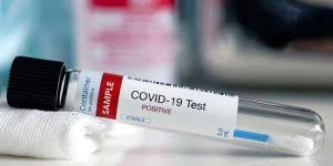 Covid in Calabria: casi in lieve diminuzione nel bollettino odierno