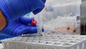 Covid in Calabria, lieve aumento dei casi (+134)