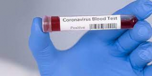 Covid in Calabria: contagi in picchiata