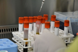 Ad Altomonte 300 vaccini antinfluenzali