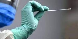 Covid, pi&ugrave; di 700 contagi nel bollettino odierno
