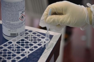 Covid: in Calabria nessuna vittima e 38 contagiati