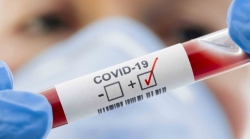 Covid: continua l'impennata dei contagi