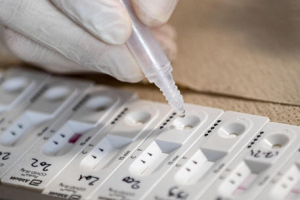 Covid: in Calabria 840 contagi e due decessi