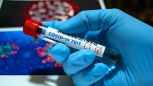 Covid: il bollettino, curva stabile