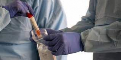 Covid: pi&ugrave; di 800 casi nel bollettino odierno, aumentano i ricoveri