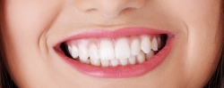 Infezioni e fallimenti degli impianti dentali ed ortopedici: nasce brevetto rivoluzionario