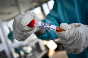 Coronavirus: tornano a salire i contagi in Calabria