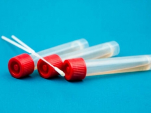 Coronavirus. Reggio Calabria: 1 positivo su 277 tamponi